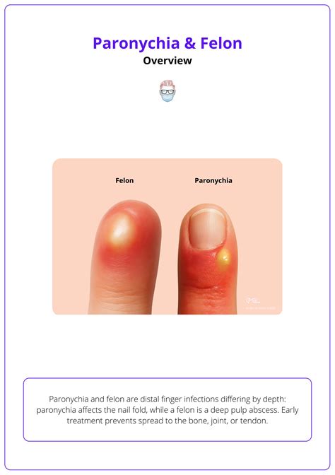Paronychia & Felon: Causes, Clinical Features, & Management