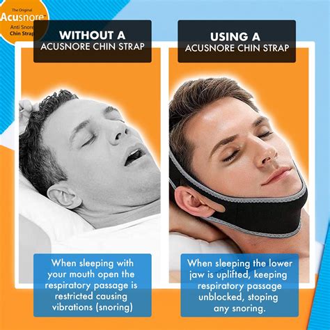 Adjustable Anti Snoring Chin Strap Belt Sleep Apnea Stop Snoring Solution Device | eBay UK