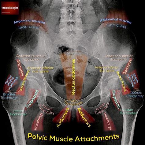 Iliac Crest Muscle Attachments