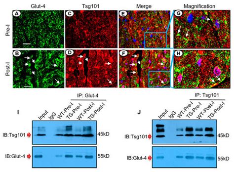 Tsg101 Is Involved in the Sorting and Re-Distribution of Glucose ...