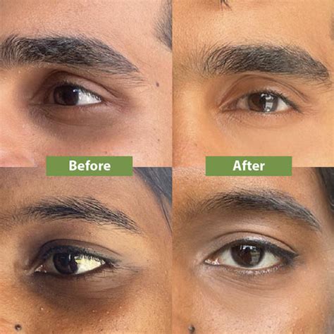 Best Natural Under Eye Cream for Dark Circles Removal | Vilvah