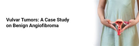 Vulvar Tumors: A Case Study on Benign Angiofibroma