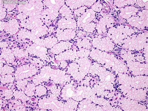 Kuvatulokset haulle brunner syndrome