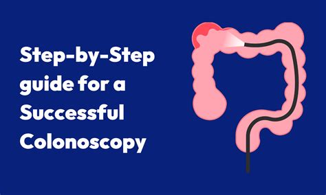 How to Prepare for a Successful Colonoscopy: A Step-by-Step Guide - Gastro Star Texas