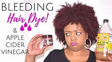 How To Hair Dye by Hair Dye Bleeding Disaster How I Stopped It Apple Cider How To Hair Dye