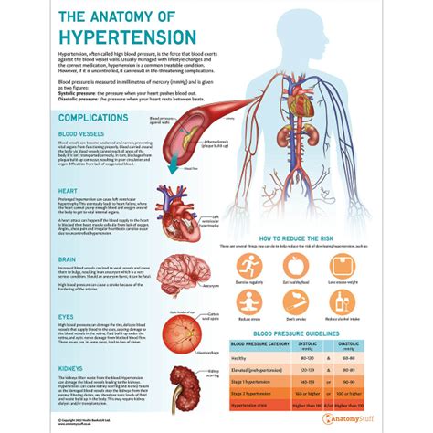 Hypertension Collection | Health Education Charts & Models Set – AnatomyStuff