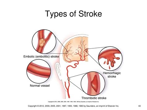 PPT - Chapter 15 PowerPoint Presentation, free download - ID:241128