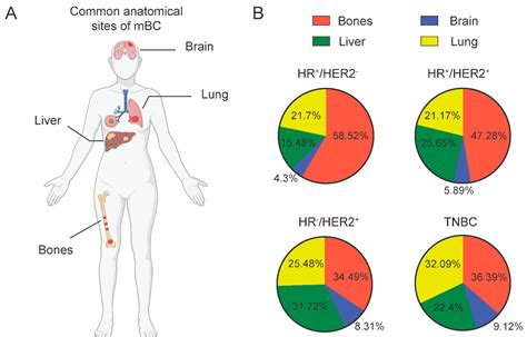 The Present and Future of Clinical Management in Metastatic Breast Cancer - how common is breast cancer