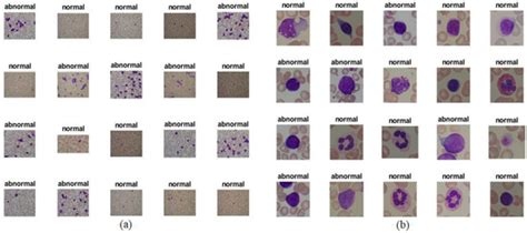 Multi-Method Diagnosis of Blood Microscopic Sample for Early Detection ...