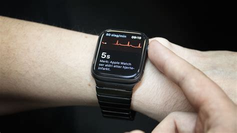 Tem jailbreak? Saiba como ativar o ECG no Apple Watch - MacMagazine