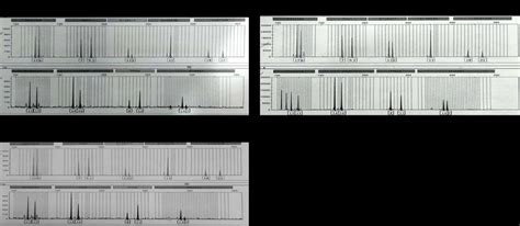 Image result for Electropherogram vs Chromatogram