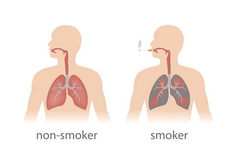The Anatomy of Smoking: How Tobacco Affects Your Body