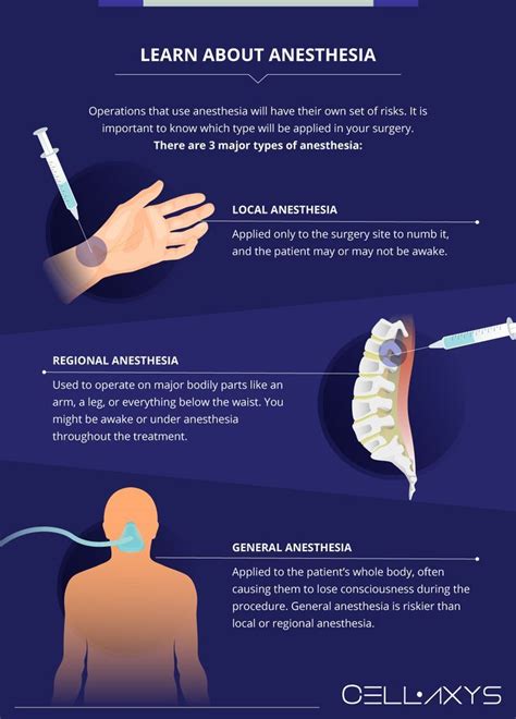 Image result for Getting Anesthesia