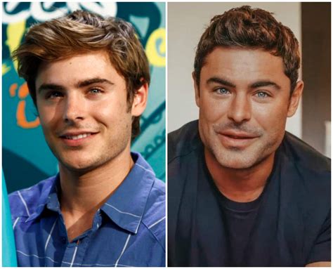 What Happened To Zac Efron'S Face? The Shocking Transformation Revealed - Rising Net Worth