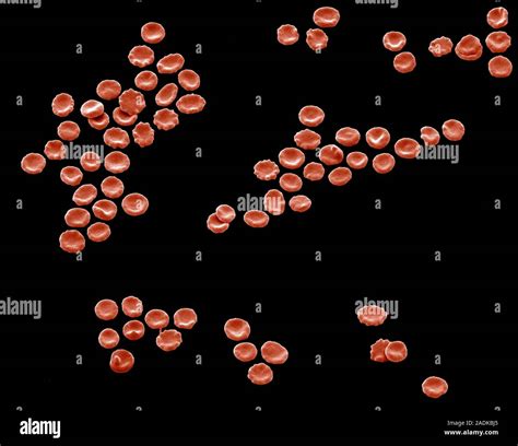 Red blood cells, coloured scanning electron micrograph (SEM). Slight ...