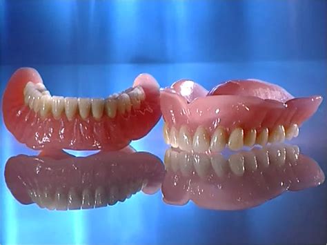 Vertical defect reconstruction and simultaneous implant placement using ...