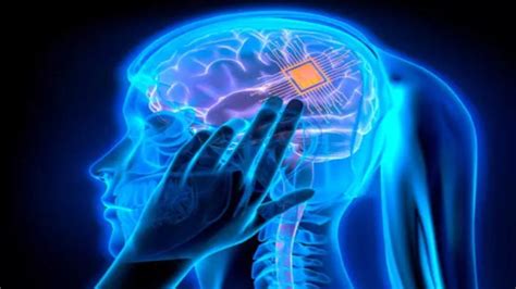 మనిషి మెదడులో ఎలక్ట్రానిక్ చిప్ అమర్చిన న్యూరాలింక్.. ఈ డివైజ్ ఎలా ...