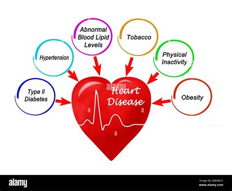 About Heart Disease – Types Of Heart Disease – KOAUJQ