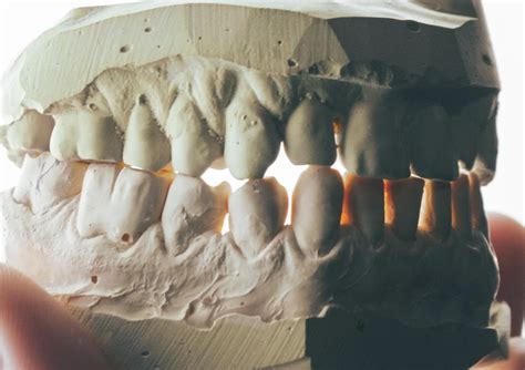How to Repair Broken Teeth: Comprehensive Treatment Options