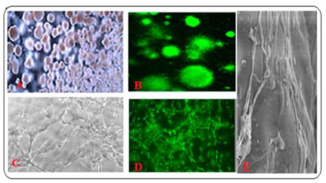 3-D Cell Culture Systems in Bone Marrow Tissue and Organoid Engineering ...