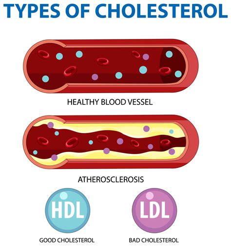 Why Is Dangerous Cholesterol