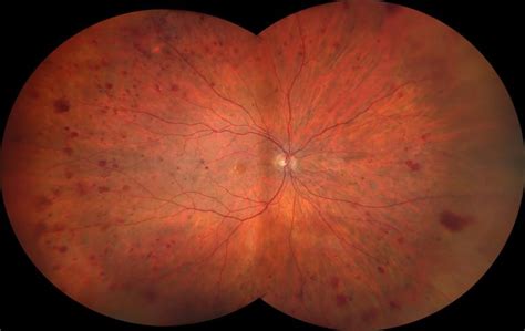 ZEISS CLARUS 500 Funduskamera