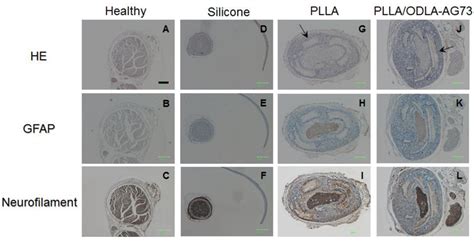 Polymers | Special Issue : Biofunctional Polymers for Medical Applications