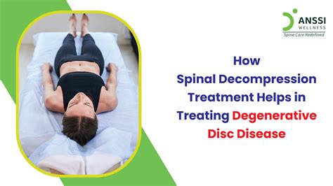 Degenerative Disc Disease Treatment Without Surgery