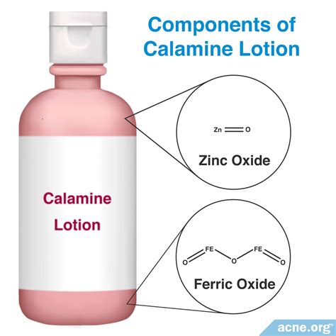 Does Calamine Lotion Help Athletes Foot at Brad Rios blog