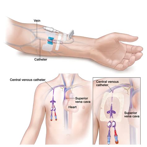 Product Information - KMED-KANGYI MEDICAL
