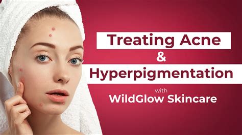 3 Different Types of Face Serum for Glowing Skin, Brightening Skin, Hy