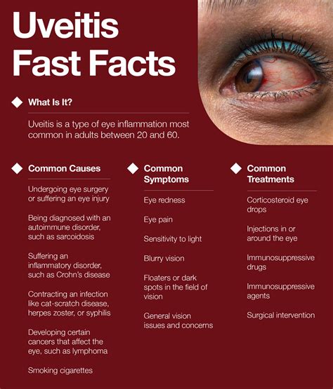 What Is Uveitis: Symptoms, Causes, Treatments – The Amino Company