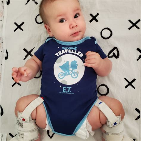 What is Hip Dysplasia? - Today's Parent