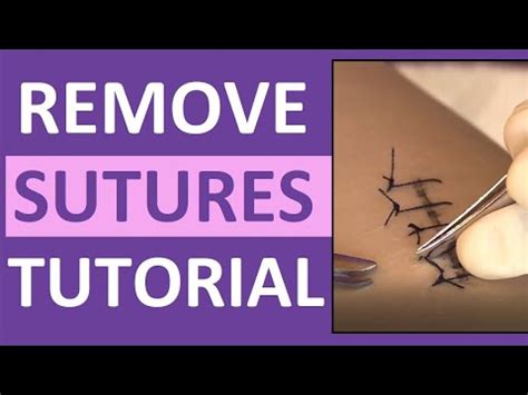 Removing Sutures Step by Step 的图像结果