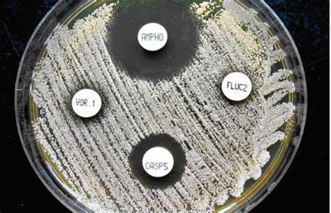Image result for Mic Disc Diffusion Method
