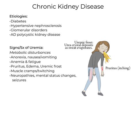 Uremia Vs Azotemia Ch 20: Renal At Indiana University School Of