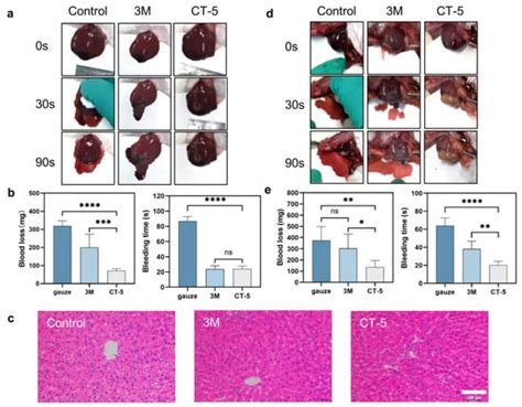 Non-Covalent Cross-Linking Hydrogel: A New Method for Visceral Hemostasis