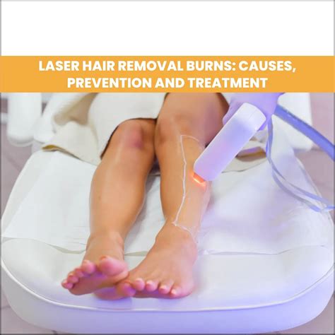 Laser Hair Removal Burns: Causes, Prevention, and Treatment - AAYNA Clinic