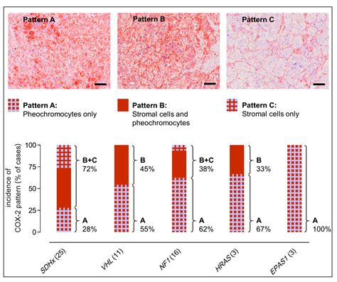 Targeting Cyclooxygenase-2 in Pheochromocytoma and Paraganglioma: Focus ...