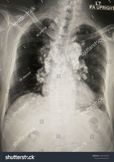 79 Estructura De La Traqueal Images, Stock Photos & Vectors | Shutterstock