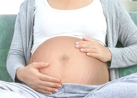 How_to_Prevent_Stretch_Marks_During_Pregnancy_1081x771_crop_center ...