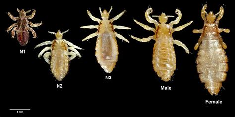 Body Lice | symptoms, diagnosis, treatment, pictures, home remedies