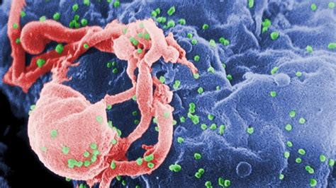 Understanding Human Immunodeficiency Virus Infection / AIDS