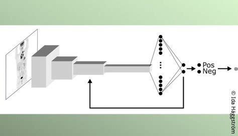 Harnessing AI for medical imaging of lymphatic cancer cases