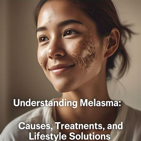 Understanding Melasma: Causes, Treatments, and Lifestyle Solutions