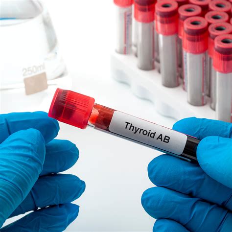 Thyroid Antibody Test