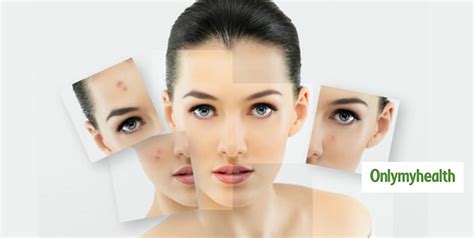 Why is pH Balance Important For Skin And How to Maintain Right pH Level ...