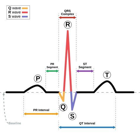 EKG for Dummies — PEDIATRIC PULSE