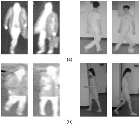 OADE-Net: Original and Attention-Guided DenseNet-Based Ensemble Network ...