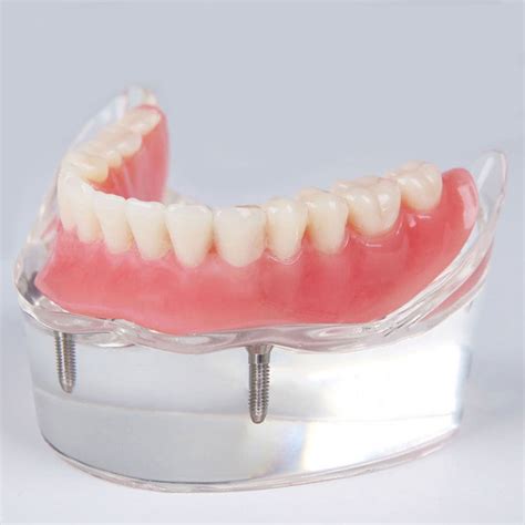 Buy MakeUp4ever Dental Overdenture Interior Mandibular Lower Teeth With ...